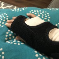 Managing Pain After Surgery